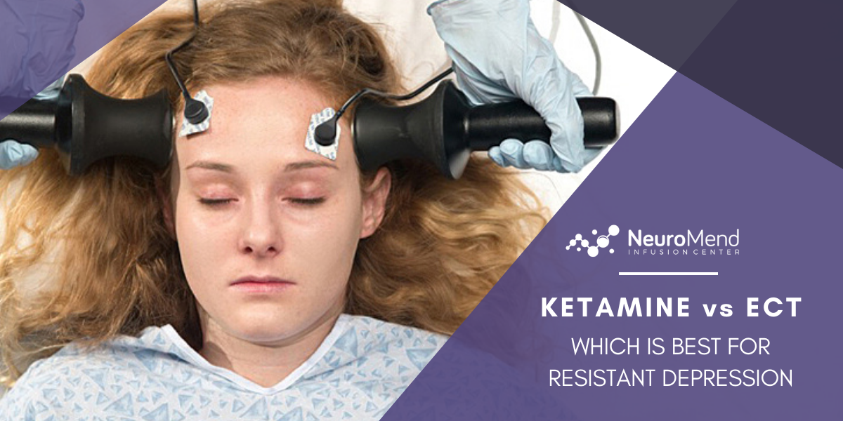 Ketamine vs ECT Which Is Best For Resistant Depression - NeuroMend